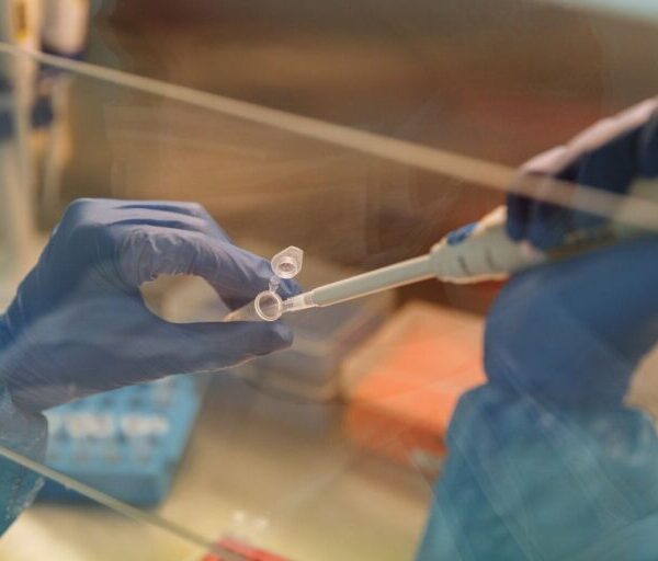 Profesional de laboratorio manipula muestras durante análisis para detectar enfermedades virales.